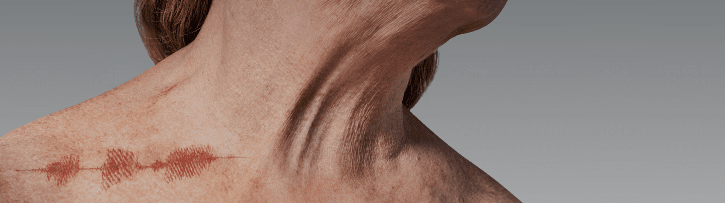 A close up of a woman's neck with a visible graphical representation of uncomfortable, itchy skin.