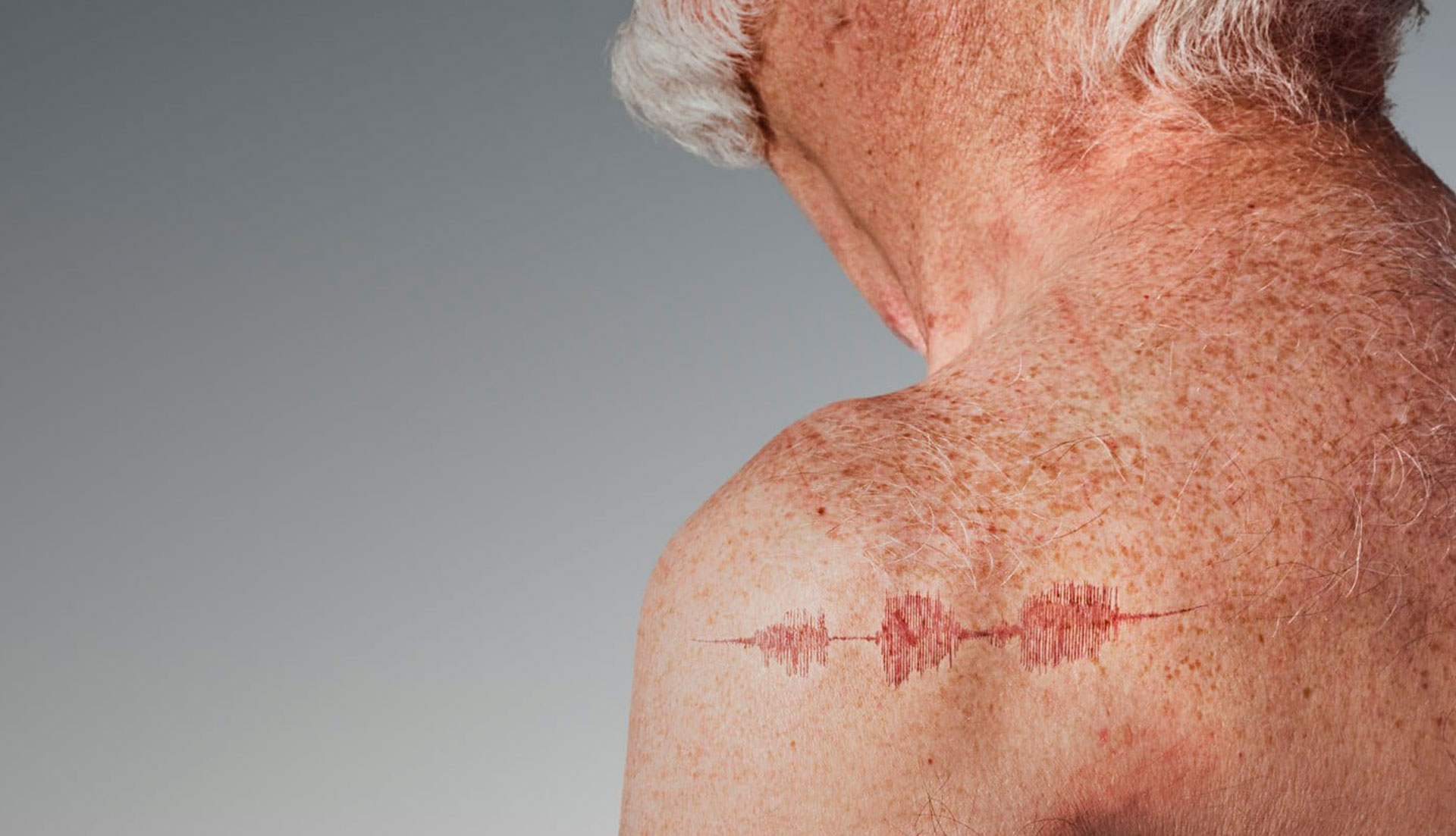 An older man, shirtless, facing away with a graphical representation of itchy skin on his back.
