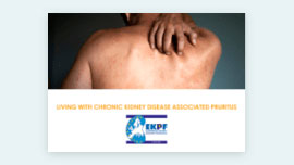 A person holding their neck in pain, symbolizing chronic pain associated with skin irretation.