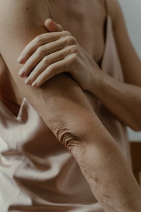 Close up of a woman in a vest with her arm across her chest holding her arm.